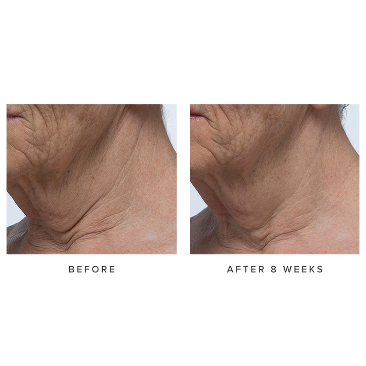 Ageless Revitalizing Neck Cream Daily Neck Cream for Moisture Support