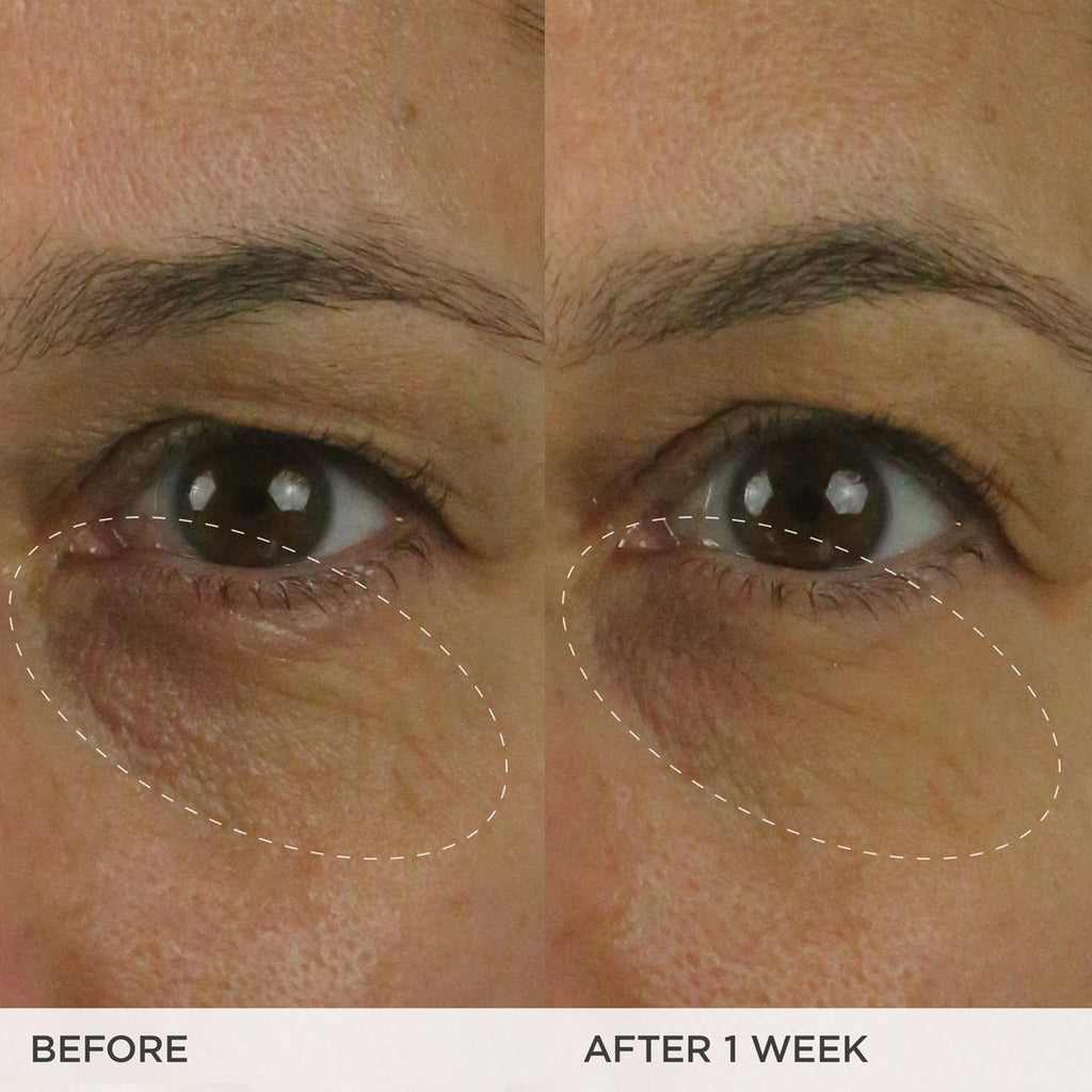 The Brightening Eye Cream Daily Eye Cream for A Range of Skin Types