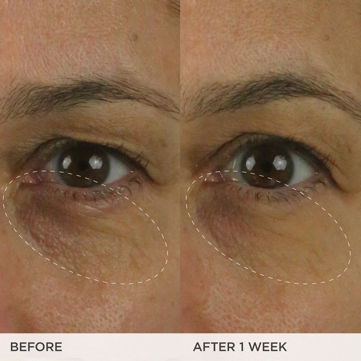 The Brightening Eye Cream Daily Eye Cream for A Range of Skin Types