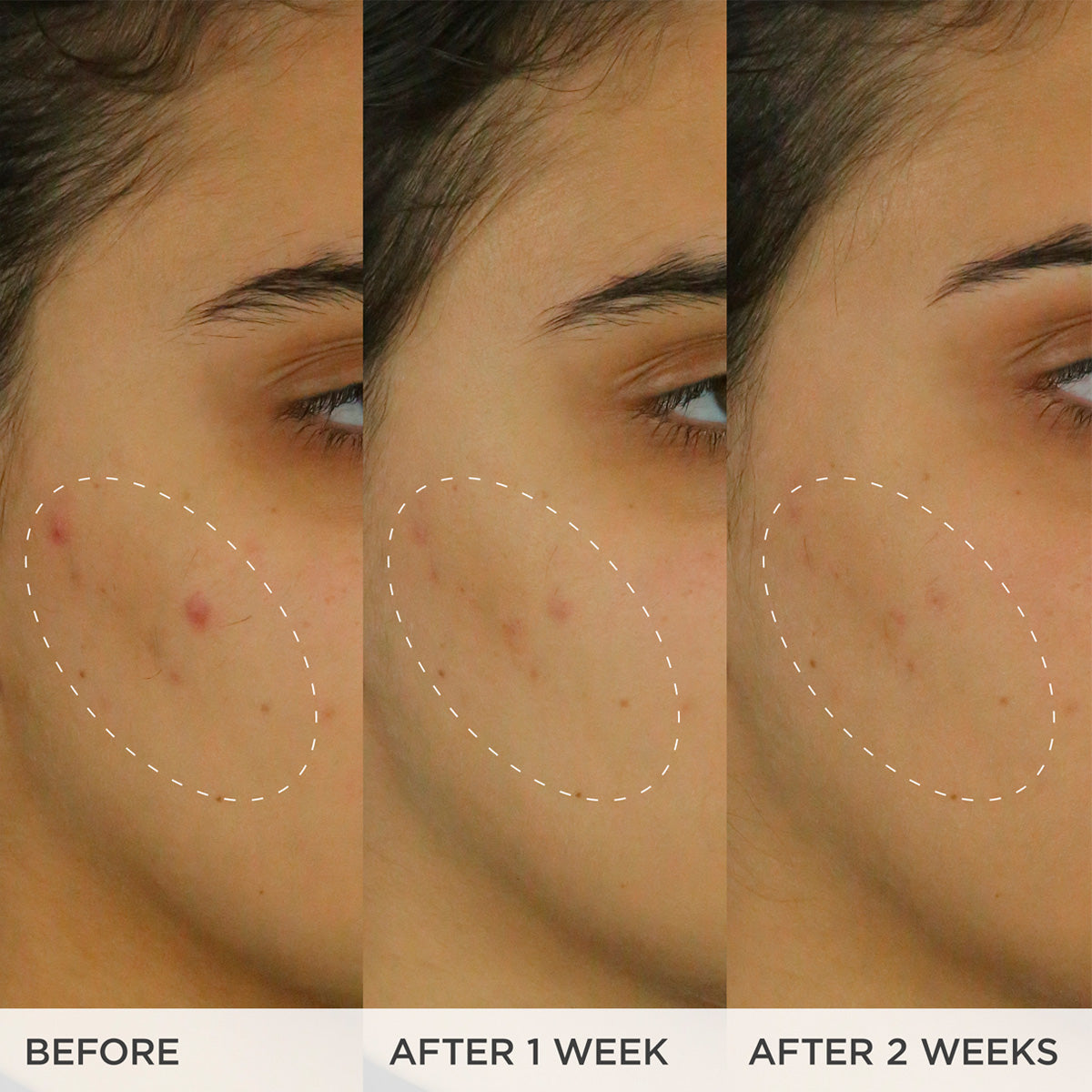 The Brightening Serum Daily Face Serum for A Range of Skin Types