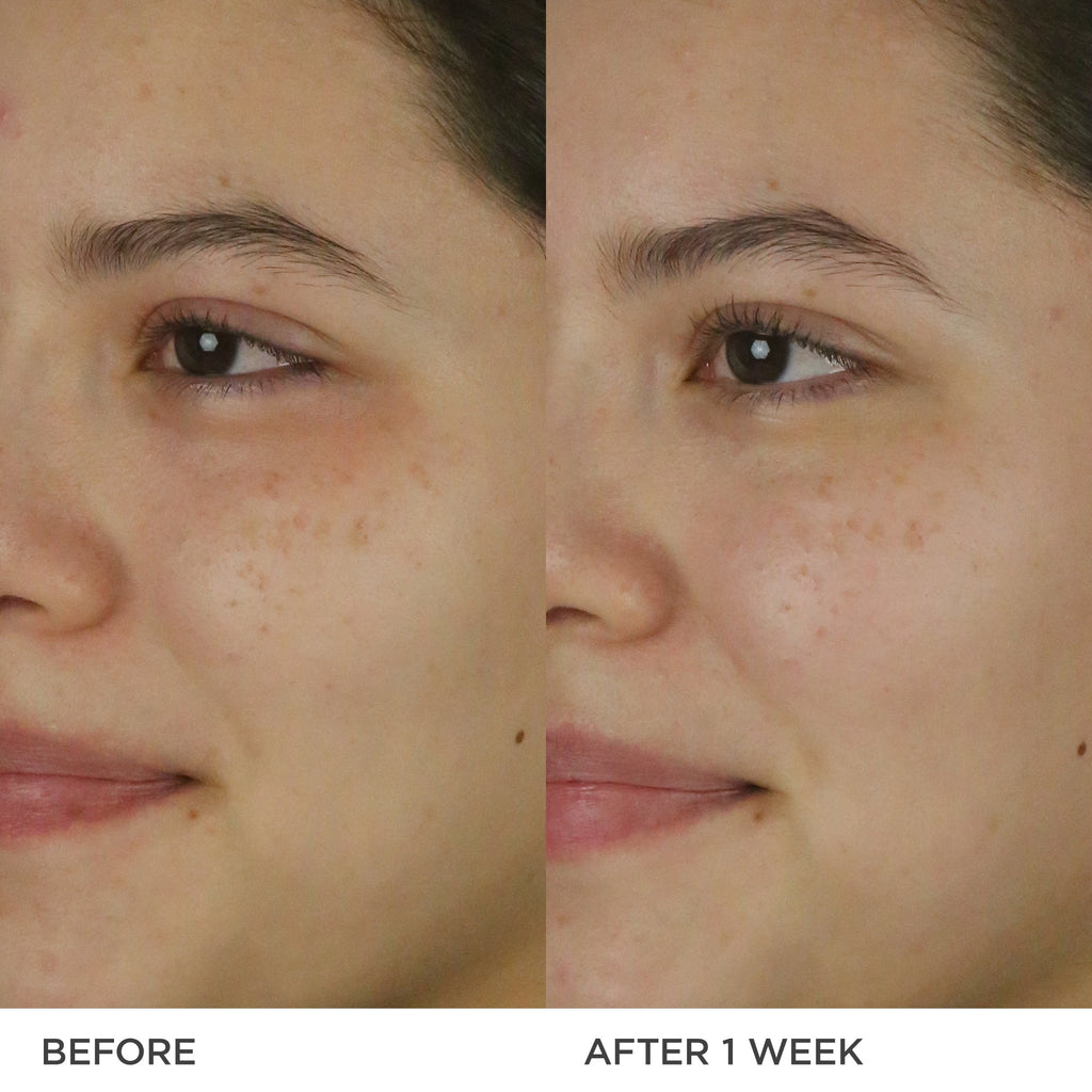 The Dewy Milk Moisturizer Daily Face Moisturizer for Combination to Oily Skin