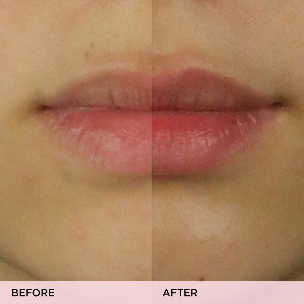 The Kissu Lip Scrub Daily Lip Scrub for Moisture Support