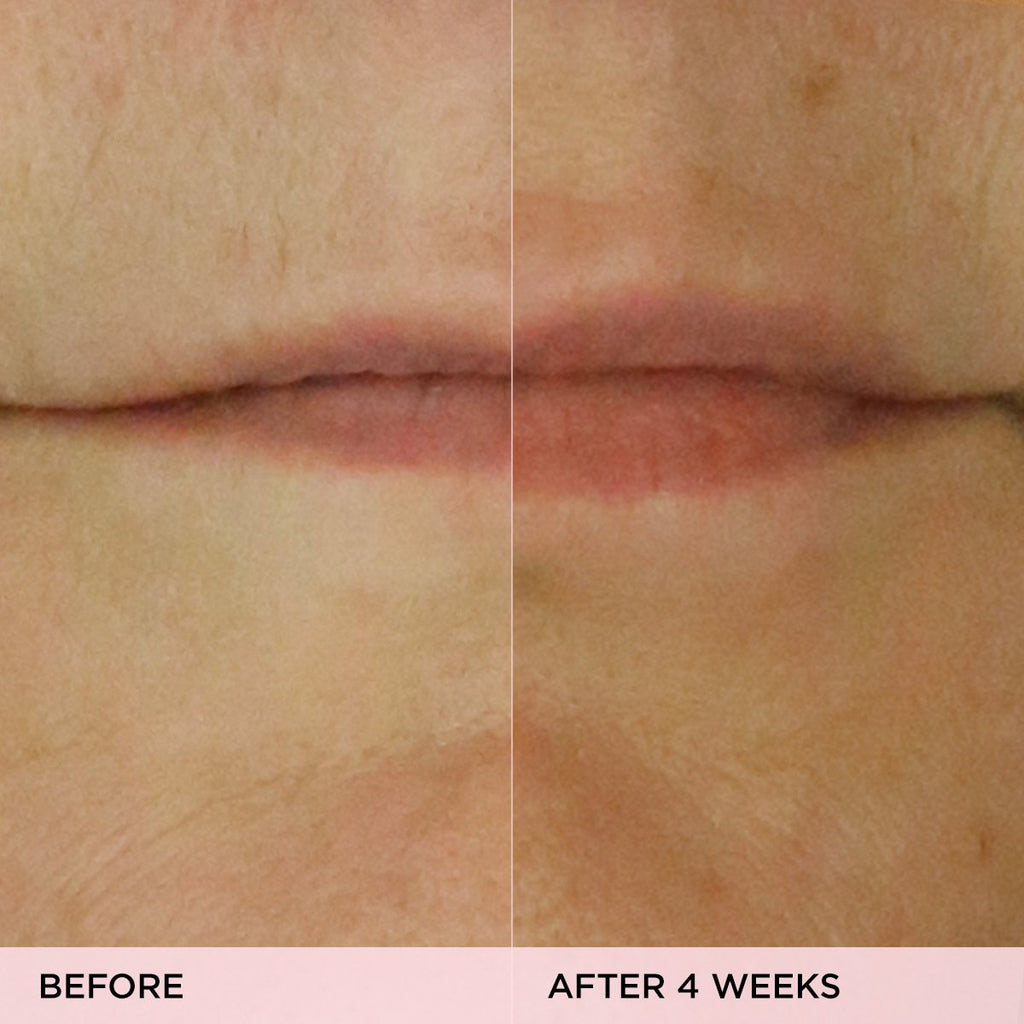 The Kissu Lip Treatment Daily Lip Care for Moisture Support