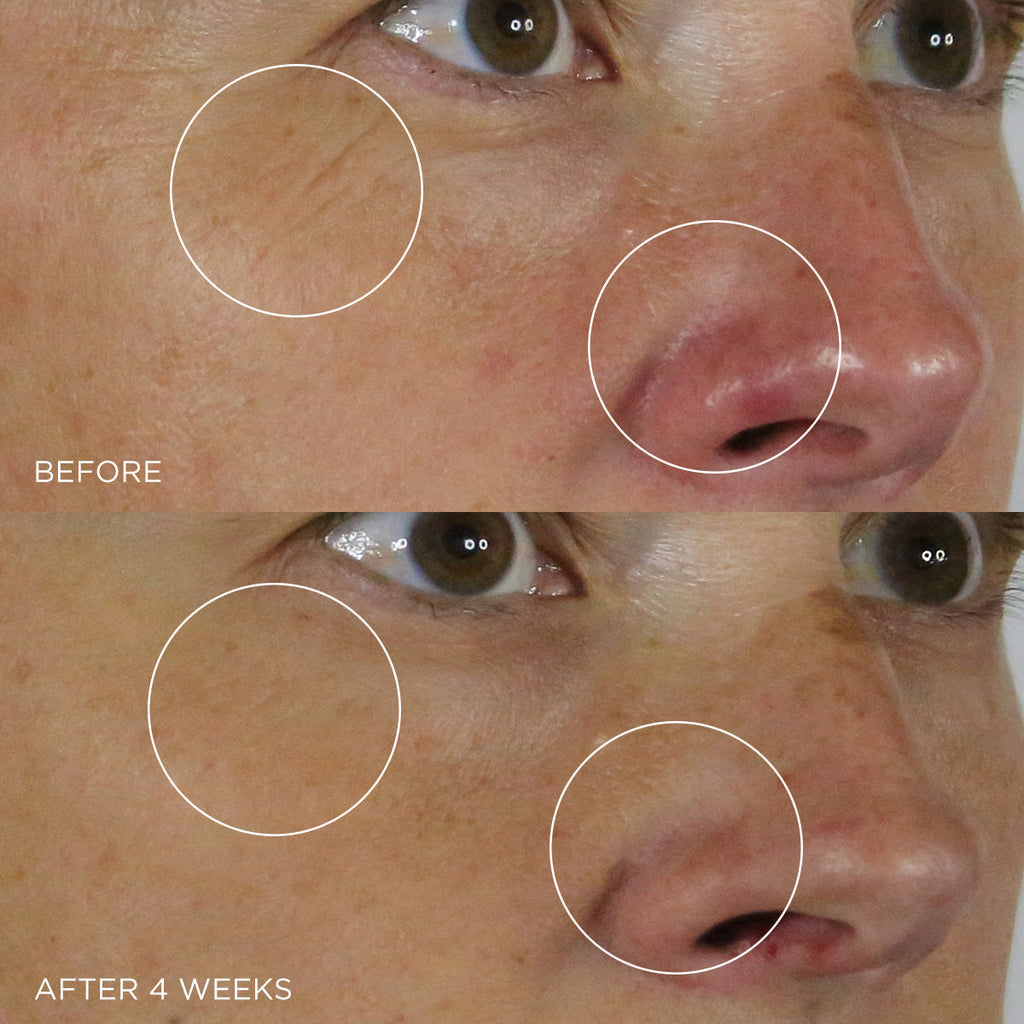 The Silk Serum Daily Face Serum for Moisture Support